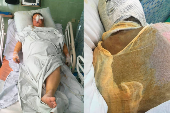 handziuk kateryna mutilated
